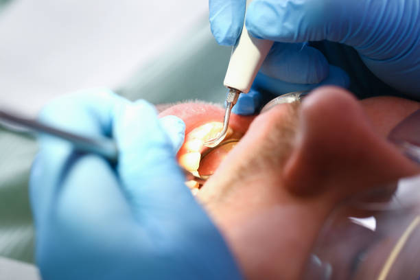 Best Emergency Gum Treatment in White Oak, MD